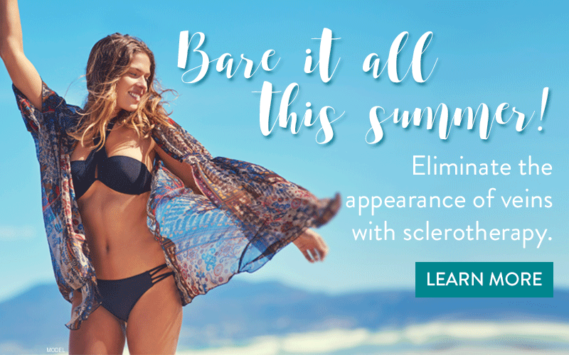 Bare it all this summer with sclerotherapy