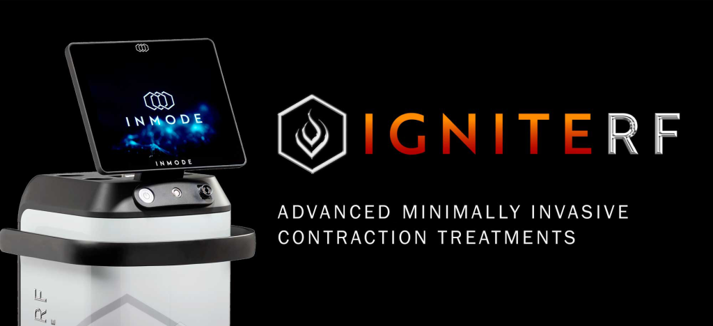 IgniteRF Advanced minimally invasive contraction treatments